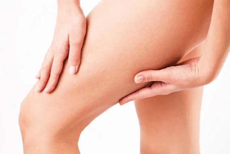 Anti Cellulite treatment Orange CA